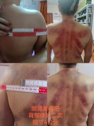 -丽减美瘦吧·减肥瘦身