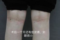 -圣嘉新医疗美容医院