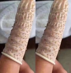 -蕾特恩专业祛痘·皮肤管理