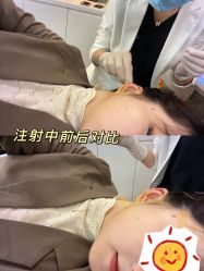 -Yestar宁波艺星整形医院