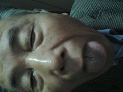 -中医推拿(永兴佳园店)