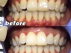 -希望齿科(河西店)