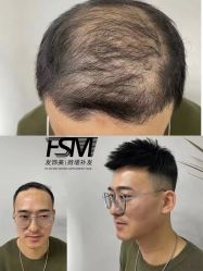 -发饰美男士增发补发假发定制店