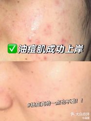 -SKIN79皮肤管理中心