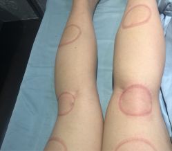 -绿竹·竹罐瘦身养生馆