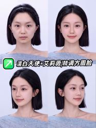 点击看大图 -深圳美莱医疗美容医院