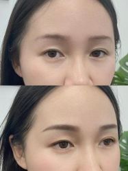 点击看大图 -张小野·专业半永久纹眉