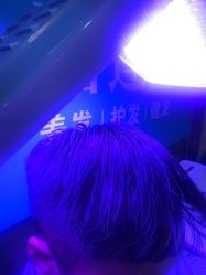 -碧莲盛·不剃发植发