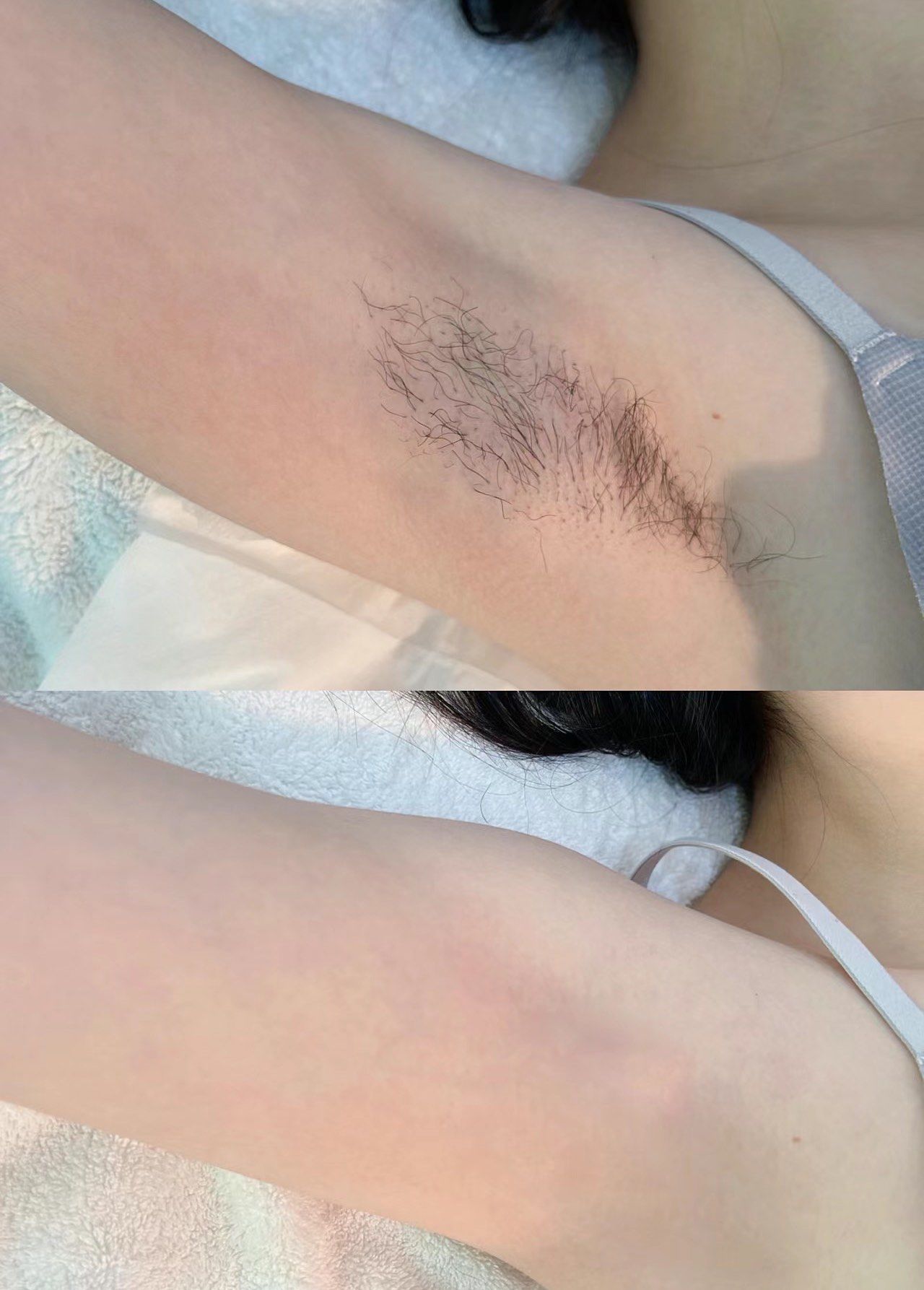 她家腋下脱毛一点也不疼