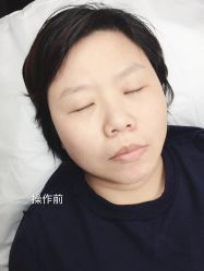 -西施无菌半永久纹绣眉眼影唇轻增发纹发际线