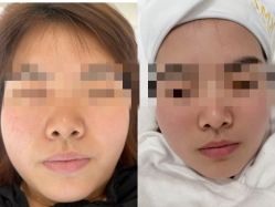 -康美贞·痘肌养护管理中心