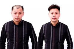 -发饰美男士增发补发假发定制店