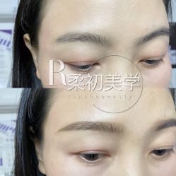 -RC半永久纹眉纹发际线