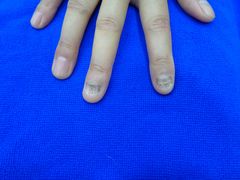 -世龙世家甲沟炎·灰指甲·嵌甲矫正·修脚(武侯区双楠店)