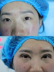 -上海伊莱美医疗美容医院