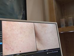 -苑苑vbeauty科技美容SPA