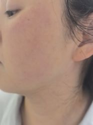 -长沙雅美医疗美容医院
