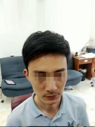 -极客侠男士假发定制补发