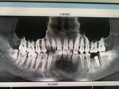 -同步齿科·数字化正畸种植口腔中心(珠海店)