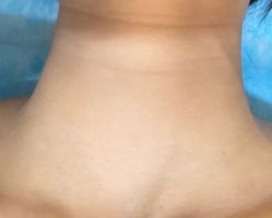 -上海玫瑰医疗美容医院