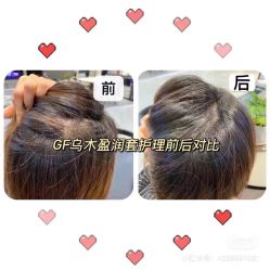 -希梵尔头皮抗衰·科技养发