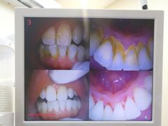-新达口腔(华东理工大学店)