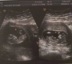 点击看大图 -天津和睦家医院