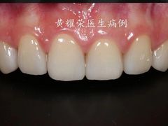 -柏乐口腔(南宁总院)