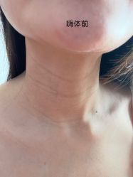 -小忠丽格医美