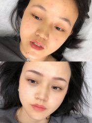 点击看大图 -西施无菌半永久纹绣眉眼影唇轻增发纹发际线