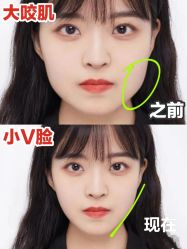 -上海漾颜医疗美容