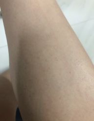 -Yestar艺星医疗美容医院