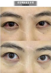 -LUNA皮相美·骨相美高级美感