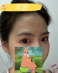 -素美医疗美容·西南眼鼻整形·修复基地