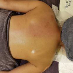 体验后-汐月Health纤体spa中心