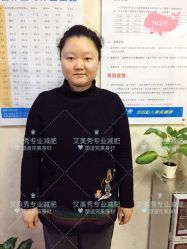 -维纳斯专业减肥