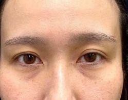 -天津健丽·去眼袋医疗美容机构