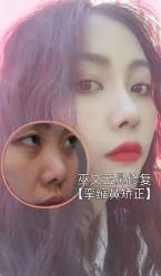 -北京米扬丽格医疗美容·联合丽格鼻整形中心