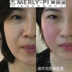 -MLP美丽派·问题肌疗愈中心