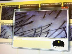 -菩叶头皮抗衰养发护发