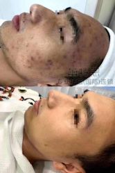 -痘敏医生专业祛痘·肌肤修复连锁