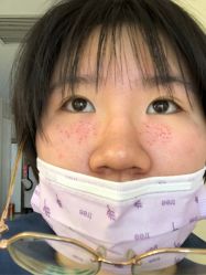 -美丽人生祛斑扁平疣汗管瘤中心