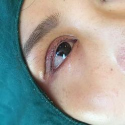 -尚玲纹绣纹眉特价店