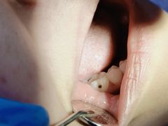 -上海崇美口腔门诊