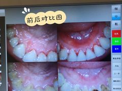 -团圆口腔·种植中心(锦江院区)