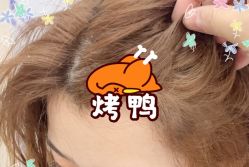 -大麦微针植发全国连锁