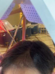 -碧莲盛·不剃发植发