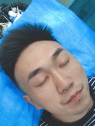 体验后-郡艺医疗美容·微整·眼鼻吸脂