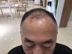 -密发堂乌发养发馆