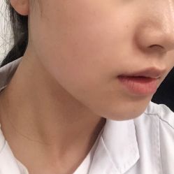 体验后-美莱医学美容医院